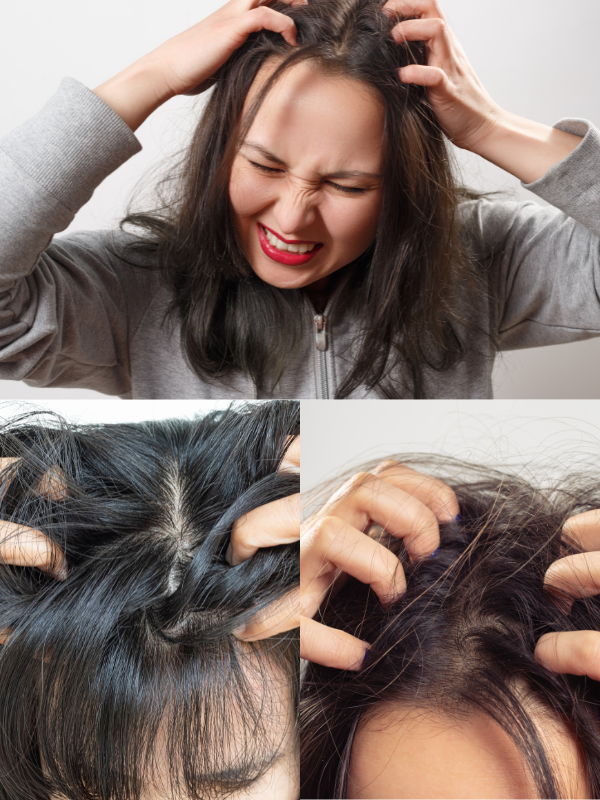 10-home-remedies-for-itchy-scalp