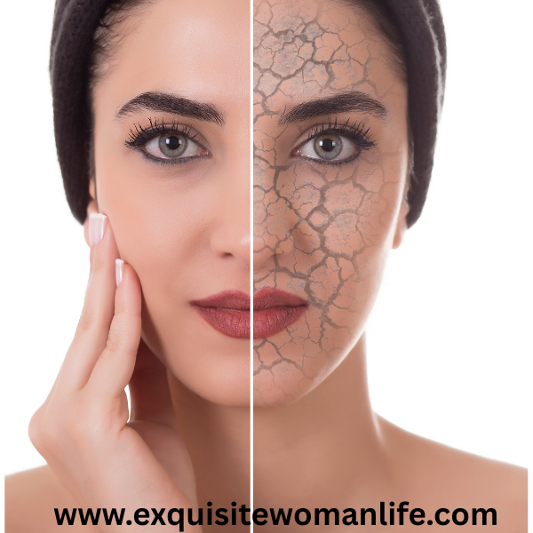 winter-routine-for-dry-skin