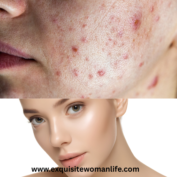 skincare-mistakes-that-ruin-your-glow