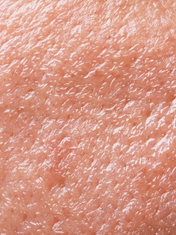 Skin-dryness-prevention