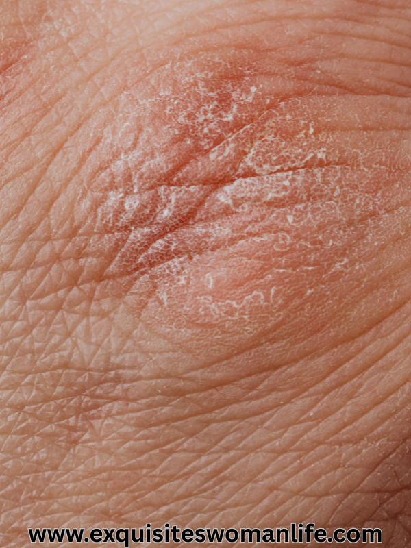 simple-ways-to-prevent-skin-dryness-in-harmattan-and-winter