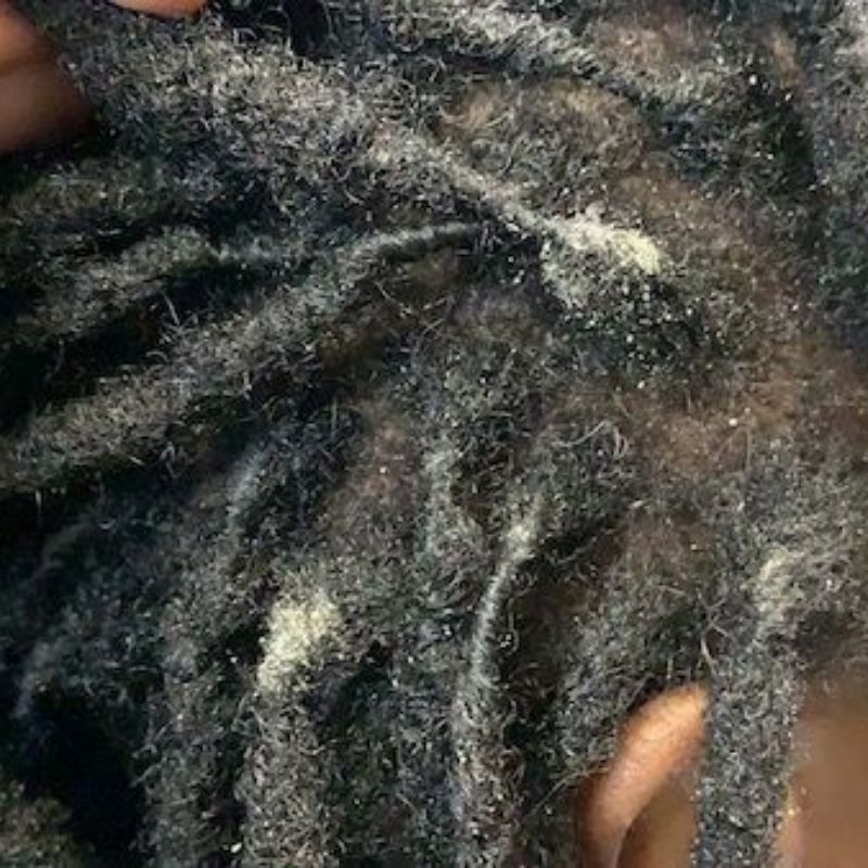 what-is-product-buildup-in-locs