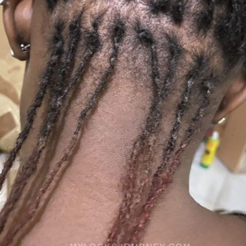 lint-in-locs