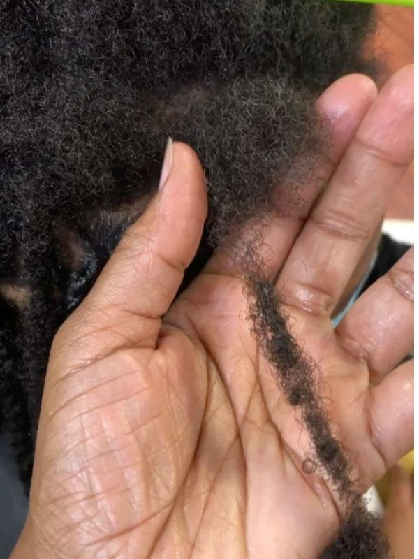 causes-of-thinning-locs
